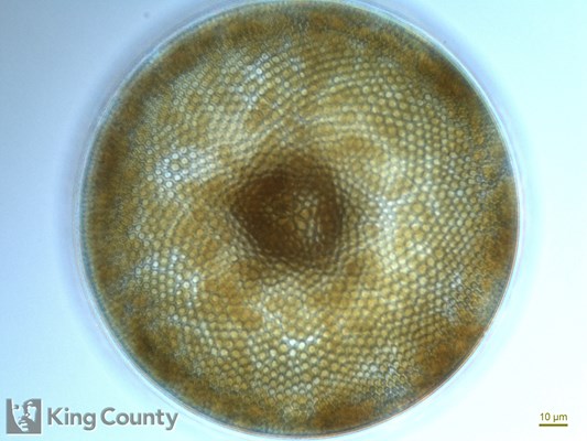 Photo of Coscinodiscus centralis